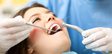 Root-Canal-Therapy