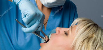 Tooth-Extractions